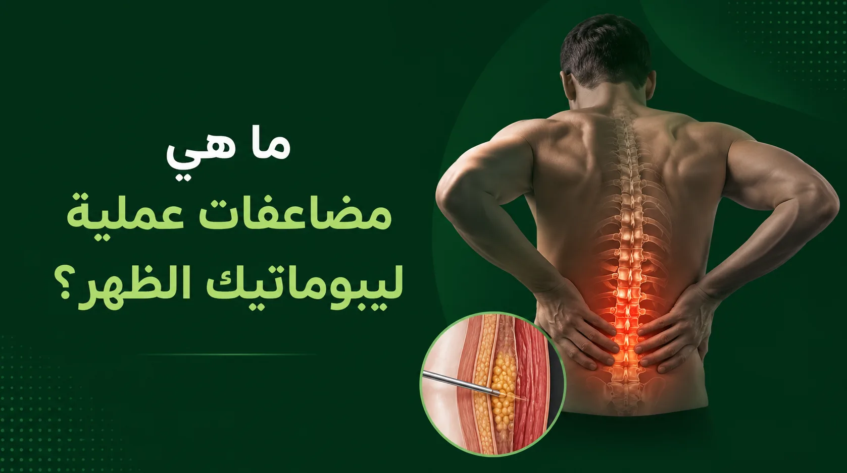 ما هي مضاعفات عملية ليبوماتيك الظهر؟